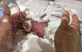 Die kleinste babaseuntjie ter wêreld is ses maande na sy geboorte uit die hospitaal ontslaan. (Foto: IANS/ANA)